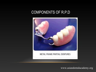 COMPONENTS OF R.P.D
www.asiandentalacademy.org
 