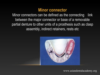 mejor connectors in removable partial dentures | PPT