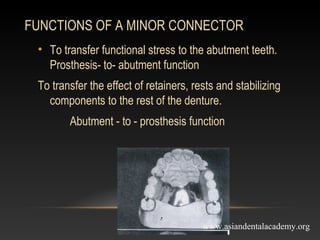 mejor connectors in removable partial dentures | PPT