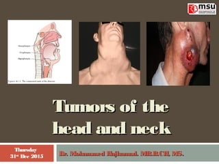 Tumors of theTumors of the
head and neckhead and neck
Dr. Mohammed Hajhamad. MB.B.CH, MS.Dr. Mohammed Hajhamad. MB.B.CH, MS.
Thursday
31st
Dec 2015
 