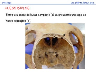 Dra. Emérita Abreu GarcíaOsteología
HUESO DIPLOE
Entre dos capas de hueso compacto (a) se encuentra una capa de
hueso esponjoso (b).
a
a
b
 