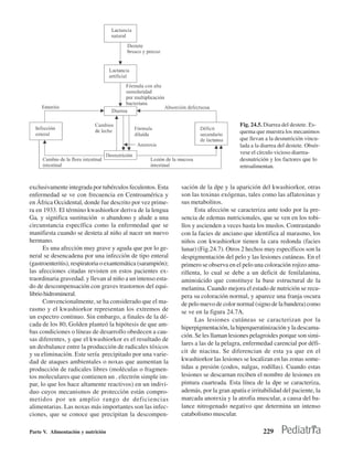 Fig. 24.5. Diarrea del destete. Es-
                                                                                      quema que muestra los mecanimos
                                                                                      que llevan a la desnutrición vincu-
                                                                                      lada a la diarrea del destete. Obsér-
                                                                                      vese el círculo vicioso diarrea-
                                                                                      desnutrición y los factores que lo
                                                                                      retroalimentan.


exclusivamente integrada por tubérculos feculentos. Esta      sación de la dpe y la aparición del kwashiorkor, otras
enfermedad se ve con frecuencia en Centroamérica y            son las toxinas exógenas, tales como las aflatoxinas y
en África Occidental, donde fue descrito por vez prime-       sus metabolitos.
ra en 1933. El término kwashiorkor deriva de la lengua              Esta afección se caracteriza ante todo por la pre-
Ga, y significa sustitución o abandono y alude a una          sencia de edemas nutricionales, que se ven en los tobi-
circunstancia específica como la enfermedad que se            llos y ascienden a veces hasta los muslos. Contrastando
manifiesta cuando se desteta al niño al nacer un nuevo        con la facies de anciano que identifica al marasmo, los
hermano.                                                      niños con kwashiorkor tienen la cara redonda (facies
      Es una afección muy grave y aguda que por lo ge-        lunar) (Fig.24.7). Otros 2 hechos muy específicos son la
neral se desencadena por una infección de tipo enteral        despigmentación del pelo y las lesiones cutáneas. En el
(gastroenteritis), respiratoria o exantemática (sarampión);   primero se observa en el pelo una coloración rojizo ama-
las afecciones citadas revisten en estos pacientes ex-        rillenta, lo cual se debe a un deficit de fenilalanina,
traordinaria gravedad. y llevan al niño a un intenso esta-    aminoácido que constituye la base estructural de la
do de descompensación con graves trastornos del equi-         melanina. Cuando mejora el estado de nutrición se recu-
librio hidromineral.                                          pera su coloración normal, y aparece una franja oscura
      Convencionalmente, se ha considerado que el ma-         de pelo nuevo de color normal (signo de la bandera) como
rasmo y el kwashiorkor representan los extremos de            se ve en la figura 24.7A.
un espectro continuo. Sin embargo, a finales de la dé-              Las lesiones cutáneas se caracterizan por la
cada de los 80, Golden planteó la hipótesis de que am-
                                                              hiperpigmentación, la hiperqueratinización y la descama-
bas condiciones o líneas de desarrollo obedecen a cau-
                                                              ción. Se les llaman lesiones pelagroides porque son simi-
sas diferentes, y que el kwashiorkor es el resultado de
                                                              lares a las de la pelagra, enfermedad carencial por défi-
un desbalance entre la producción de radicales tóxicos
y su eliminación. Este sería precipitado por una varie-       cit de niacina. Se diferencian de esta ya que en el
dad de ataques ambientales o noxas que aumentan la            kwashiorkor las lesiones se localizan en las zonas some-
producción de radicales libres (moléculas o fragmen-          tidas a presión (codos, nalgas, rodillas). Cuando estas
tos moleculares que contienen un . electrón simple im-        lesiones se descarnan reciben el nombre de lesiones en
par, lo que los hace altamente reactivos) en un indivi-       pintura cuarteada. Esta línea de la dpe se caracteriza,
duo cuyos mecanismos de protección están compro-              además, por la gran apatía e irritabilidad del paciente, la
metidos por un amplio rango de deficiencias                   marcada anorexia y la atrofia muscular, a causa del ba-
alimentarias. Las noxas más importantes son las infec-        lance nitrogenado negativo que determina un intenso
ciones, que se conoce que precipitan la descompen-            catabolismo muscular.

Parte V. Alimentación y nutrición                                                               229
 