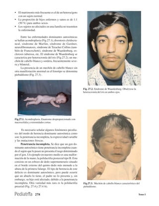 • El matrimonio más frecuente es el de un heterocigoto
   con un sujeto normal.
• La proporción de hijos enfermos y sanos es de 1:1
   (50 %) para ambos sexos.
• Los sujetos no afectados en una familia no trasmiten
   la enfermedad.

      Entre las enfermedades dominantes autosómicas
se hallan acondroplasia (Fig.27.1), disostosis cleidocra-
neal, síndrome de Marfán, síndrome de Gardner,
neurofibromatosis, síndrome de Treacher Collins (tam-
bién de Franceschetti), síndrome de Waardenburg, es-
clerosis tuberosa, etc. El síndrome de Waardenburg se
caracteriza por heterocromía del iris (Fig.27.2), un me-
chón de cabello blanco y sordera, frecuentemente seve-
ra y bilateral..
      La presencia de un mechón de cabello blanco sin
otra manifestación anormal en el fenotipo se denomina
piebaldismo (Fig. 27.3) .



                                                             Fig. 27.2. Síndrome de Waardenburg. Obsérvese la
                                                             heterocromía del iris en ambos ojos.




Fig.27.1. Acondroplasia. Enanismo desproporcionado con
macrocefalia y extremidades cortas.

       Es necesario señalar algunos fenómenos peculia-
res del modo de herencia dominante autosómica como
son: la penetrancia incompleta, la expresividad variable
y las mutaciones frescas.
      Penetrancia incompleta. Se dice que un gen do-
minante autosómico tiene penetrancia incompleta cuan-
do el sujeto que lo posee no presenta el rasgo determinado
por el gen. Un ejemplo en nuestro medio es una malfor-
mación de la mano, la polidactilia postaxial tipo B. Esta
consiste en un esbozo de dedo supernumerario situado
en el borde externo del quinto dedo más menudo a la
altura de la primera falange. El tipo de herencia de este
defecto es dominante autosómico, pero puede ocurrir
que un abuelo lo tiene, el padre no lo presenta y, sin
embargo, su hijo está afectado, debido a la penetrancia
incompleta. Otra variedad más rara es la polidactilia        Fig.27.3. Mechón de cabello blanco característico del
preaxial (Fig. 27.4 y 27.4 A).                               piebaldismo.


                  278                                                                                           Tomo I
 