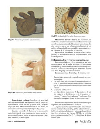 Fig.27.5. Sindactilia del 3er. y 4to. dedos en la mano.

 Fig. 27.4. Polidactilia preaxial en la mano derecha.          Mutaciones frescas o nuevas. En ocasiones, en
                                                          una familia sin antecedentes de afección hereditaria, nace
                                                          un niño con una enfermedad dominante autosómica. Se
                                                          dice entonces que en una célula germinal de uno de los
                                                          padres se ha producido una mutación espontánea o fres-
                                                          ca, causante de la enfermedad en cuestión.
                                                               Ejemplos de mutaciones frescas son la acondro-
                                                          plasia y la neurofibromatosis o enfermedad de Von
                                                          Recklinghausen.
                                                          Enfermedades recesivas autosómicas
                                                               Las enfermedades recesivas autosómicas son pro-
                                                          ducidas por un par de alelos recesivos. El enfermo es
                                                          homocigoto y el matrimonio más frecuente en la prácti-
                                                          ca es de 2 individuos heterocigotos, portadores de una
                                                          sola dosis del gen y con fenotipo normal.
                                                               Las características de este tipo de herencia son:

                                                          • Raras y se presentan más a menudo,cuando hay con-
                                                             sanguinidad.
                                                          • Los individuos afectados son de una misma genera-
                                                            ción. El patrón de herencia es horizontal, mientras
                                                            que en las enfermedades dominantes autosómicas es
                                                            vertical.
                                                          • Se afectan ambos sexos.
 Fig.27.4 A. Polidactilia posaxial en la mano derecha.    • Los hijos de un matrimonio de 2 portadores de un
                                                            gen recesivo se distribuyen, en la proporción si-
                                                            guiente: 1/4 sanos, ½ portadores y 1/4 enfermos. Los
                                                            sanos y los portadores tienen un fenotipo normal.
       Expresividad variable. Se refiere a la severidad
 del rasgo determinado por el gen anormal en las perso-         Los errores congénitos del metabolismo tienen, por
 nas afectadas. Puede ser más grave en unas y más be-     lo general, un modo de herencia recesivo.
 nigna en otras. Otra malformación de los dedos, la              Algunos ejemplos de enfermedades autosómicas
 sindactilia, constituye un ejemplo típico (Fig. 27.5).   recesivas son el albinismo (Fig. 27.6), la fenilcetonuria,
       Cuando su modo de herencia es dominante            la fibrosis quística del páncreas y la mucopolisacaridosis
 autosómico puede ocurrir en una sola mano, pero a ve-    tipo 1, o síndrome de Hurler (MPSI), la porfiria
 ces se manifiesta en ambas y puede presentarse, ade-     eritropoyética congénita (Fig. 27.7) y el síndrome de Smith
 más, en uno o en ambos pies.                             Lemli Opitz.

Parte VI. Genética Médica                                                                      279
 