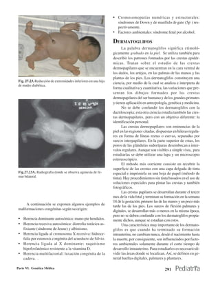 • Cromosomopatías numéricas y estructurales:
                                                                  síndromes de Down y de maullido de gato (5p- ) res-
                                                                  pectivamente.
                                                                • Factores ambientales: síndrome fetal por alcohol.

                                                                DERMATOGLIFOS
                                                                      La palabra dermatoglifos significa etimoló-
                                                                gicamente grabado en la piel. Se utiliza también para
                                                                describir los patrones formados por las crestas epidér-
                                                                micas. Tratan sobre el estudio de las crestas
                                                                dermopapilares que se encuentran en la cara ventral de
                                                                los dedos, los artejos, en las palmas de las manos y las
                                                                plantas de los pies. Los dermatoglifos constituyen una
 Fig. 27.23. Reducción de extremidades inferiores en una hija
                                                                ciencia, por medio de la cual se analiza e interpreta de
 de madre diabética.
                                                                forma cualitativa y cuantitativa, las variaciones que pre-
                                                                sentan los dibujos formados por las crestas
                                                                dermopapilares del ser humano y de los grandes primates
                                                                y tienen aplicación en antropología, genética y medicina.
                                                                      No se debe confundir los dermatoglifos con la
                                                                dactiloscopia; esta otra ciencia estudia también las cres-
                                                                tas dermopapilares, pero con un objetivo diferente: la
                                                                identificación personal.
                                                                      Las crestas dermopapilares son eminencias de la
                                                                piel en las regiones citadas, dispuestas en hileras regula-
                                                                res en forma de líneas rectas o curvas, separadas por
                                                                surcos interpapilares. En la parte superior de estas, los
                                                                poros de las glándulas sudoríparas desembocan a inter-
                                                                valos regulares. Aunque son visibles a simple vista, para
                                                                estudiarlas se debe utilizar una lupa y un microscopio
                                                                estereoscópico.
                                                                      El método más corriente consiste en recubrir la
                                                                superficie de las crestas con una capa delgada de tinta
 Fig.27.23A. Radiografía donde se observa agenesia de fé-       especial e imprimirla en una hoja de papel (método de
 mur bilateral.                                                 tinta). Hay procedimientos sin tinta basados en el uso de
                                                                soluciones especiales para pintar las crestas y también
                                                                fotográficos.
                                                                      Las crestas papilares se desarrollan durante el tercer
                                                                mes de la vida fetal y terminan su formación en la semana
                                                                18 de la gestación; primero las de las manos y un poco más
     A continuación se exponen algunos ejemplos de
                                                                tarde las de los pies. Los surcos de flexión palmares y
 malformaciones congénitas según su origen:                     digitales, se desarrollan más o menos en la misma época,
                                                                pero no se deben confundir con los dermatoglifos propia-
 • Herencia dominante autosómica: mano-pie hendidos.            mente dichos, aunque se estudian con estos.
 • Herencia recesiva autosómica: distrofia torácica as-               Una característica muy importante de los dermato-
   fixiante (síndrome de Jeune) y albinismo.                    glifos es que cuando ha terminado su formación
 • Herencia ligada al cromosoma X recesiva: hidroce-            intrauterina, no cambian nunca, desde el nacimiento hasta
   falia por estenosis congénita del acueducto de Silvio.       la muerte, por consiguiente, son influenciados por facto-
 • Herencia ligada al X dominante: raquitismo                   res ambientales solamente durante el corto tiempo de
   hipofosfatémico resistente a la vitamina D.                  desarrollo intrauterino. Para estudiarlos es necesario di-
 • Herencia multifactorial: luxación congénita de la            vidir las áreas donde se localizan. Así, se definen en ge-
   cadera. .                                                    neral huellas digitales, palmares y plantares.

Parte VI. Genética Médica                                                                          291
 