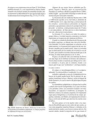 da origen es un cromosoma extra en el par 21. Se le llama            Algunos de sus rasgos fueron señalados por Es-
 también trisomía 21 y sus características clínicas funda-      quirol, Seguin y Duncan, pero su caracterización
 mentales son el retraso mental, las anomalías faciales, par-   fenotípica se atribuye a Robert Langdon Down (1866),
 ticularmente la oblicuidad de los ojos que ha dado lugar a     médico inglés que describió el fenotipo en niños de una
 la denominación de mongolismo (Fig. 27.33 y 27.33 A).          institución para retrasados mentales.
                                                                      La frecuencia de este síndrome fluctúa entre 1:500
                                                                a 1:800 recién nacidos vivos. En Cuba es alrededor de
                                                                1:1000 nacidos vivos, algo mas baja a consecuencia de
                                                                los estudios cromosómicos prenatales en liquido
                                                                amniotico, que permiten conocer el cariotipo fetal. Este
                                                                proceder se realizan a toda gestante mayor de 35 años
                                                                o con antecedentes de hijos previos u otros familiares
                                                                con esta aberracion cromosómica.
                                                                      La trisomía 21 se observa en todos los países y
                                                                grupos étnicos. La edad materna avanzada es un factor
                                                                importante en la aparición del síndrome de Down.
                                                                      Cuando se estudia la distribución de frecuencia de
                                                                las edades maternas, se obtiene una curva de distribu-
                                                                ción bimodal. Un hecho importante en relación con la
                                                                edad materna, es el aumento de la aparición de este sín-
                                                                drome a medida que la edad avanza. Antes se estimaba
                                                                que la edad media de las madres de trisómicos era de
                                                                35 años, pero estudios recientes han mostrado que es de
                                                                30 años; la edad media paterna es de 31 años.
                                                                      El peso y la talla del niño con síndrome de Down
                                                                son más bajos de lo habitual al término del embarazo.
                                                                Con la edad, la talla se mantiene por debajo de los valo-
                                                                res normales y el peso, por el contrario, tiende a ser
                                                                mayor; por lo que son “rechonchos” y de baja estatura.
                                                                CUADRO CLÍNICO
                                                                      El cráneo es microbraquicefálico y el occipucio,
                                                                aplanado. La microcefalia es moderada. La cara
                                                                      redonda y aplanada a causa de la hipoplasia de los
                                                                huesos de la parte media facial. Por lo general, de pe-
                                                                queños mantienen la boca abierta y sacan la lengua de
                                                                modo llamativo, lo cual es motivo de preocupación para
                                                                los padres.
                                                                      Las hendiduras palpebrales se dirigen hacia arriba
                                                                y afuera (desviación mongoloidea). Las cejas son finas
                                                                y las pestañas cortas. Los trastornos oculares son muy
                                                                frecuentes, en especial el estrabismo, el nistagmo, la
                                                                blefaritis crónica y la catarata congénita. Un importante
                                                                signo para el diagnóstico es la forma de las orejas: pe-
                                                                queñas, redondas, sin lóbulos, de implantación normal o
                                                                baja y con la raíz de hélix que atraviesa la concha (cruz
                                                                de hélix).
                                                                      En otros países se le da mucho valor a las man-
                                                                chas de Brushfield, que en estos niños de ojos azules, se
 Fig. 27.33. Síndrome de Down: obsérvese la desviación          ven como pequeñas manchas blancas y redondas en la
 mongoloidea de hendiduras palpebrales. A. Orejas pequeñas      unión del tercio medio con el tercio externo del iris. En
 de implantación baja con cruz de hélix.                        nuestro medio, donde la mayoría de los que tienen el

Parte VI. Genética Médica                                                                         299
 