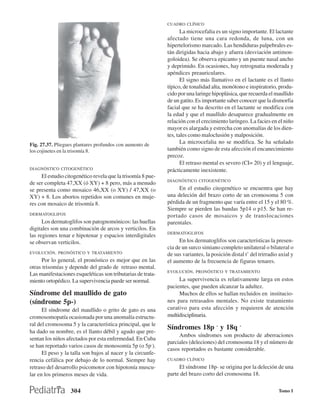 CUADRO CLÍNICO
                                                                    La microcefalia es un signo importante. El lactante
                                                             afectado tiene una cara redonda, de luna, con un
                                                             hipertelorismo marcado. Las hendiduras palpebrales es-
                                                             tán dirigidas hacia abajo y afuera (desviación antimon-
                                                             goloidea). Se observa epicanto y un puente nasal ancho
                                                             y deprimido. En ocasiones, hay retrognatia moderada y
                                                             apéndices preauriculares.
                                                                    El signo más llamativo en el lactante es el llanto
                                                             típico, de tonalidad alta, monótono e inspiratorio, produ-
                                                             cido por una laringe hipoplásica, que recuerda el maullido
                                                             de un gatito. Es importante saber conocer que la dismorfia
                                                             facial que se ha descrito en el lactante se modifica con
                                                             la edad y que el maullido desaparece gradualmente en
                                                             relación con el crecimiento laríngeo. La facies en el niño
                                                             mayor es alargada y estrecha con anomalías de los dien-
                                                             tes, tales como maloclusión y malposición.
Fig. 27.37. Pliegues plantares profundos con aumento de
                                                                    La microcefalia no se modifica. Se ha señalado
los cojinetes en la trisomía 8.                              también como signo de esta afección el encanecimiento
                                                             precoz.
                                                                    El retraso mental es severo (CI= 20) y el lenguaje,
DIAGNÓSTICO CITOGENÉTICO                                     prácticamente inexistente.
     El estudio citogenético revela que la trisomía 8 pue-
                                                             DIAGNÓSTICO CITOGENÉTICO
de ser completa 47,XX (ó XY) + 8 pero, más a menudo
se presenta como mosaico 46,XX (o XY) / 47,XX (o                  En el estudio citogenético se encuentra que hay
XY) + 8. Los abortos repetidos son comunes en muje-          una deleción del brazo corto de un cromosoma 5 con
res con mosaico de trisomía 8.                               pérdida de un fragmento que varía entre el 15 y el 80 %.
                                                             Siempre se pierden las bandas 5p14 o p15. Se han re-
DERMATOGLIFOS                                                portado casos de mosaicos y de translocaciones
      Los dermatoglifos son patognomónicos: las huellas      parentales.
digitales son una combinación de arcos y verticilos. En
                                                             DERMATOGLIFOS
las regiones tenar e hipotenar y espacios interdigitales
se observan verticilos.                                           En los dermatoglifos son características la presen-
                                                             cia de un surco simiano completo unilateral o bilateral o
EVOLUCIÓN, PRONÓSTICO Y TRATAMIENTO                          de sus variantes, la posición distal t’ del trirradio axial y
     Por lo general, el pronóstico es mejor que en las       el aumento de la frecuencia de figuras tenares.
otras trisomías y depende del grado de retraso mental.
                                                             EVOLUCIÓN, PRONÓSTICO Y TRATAMIENTO
Las manifestaciones esqueléticas son tributarias de trata-
miento ortopédico. La supervivencia puede ser normal.             La supervivencia es relativamente larga en estos
                                                             pacientes, que pueden alcanzar la adultez.
Síndrome del maullido de gato                                     Muchos de ellos se hallan recluidos en institucio-
(síndrome 5p-)                                               nes para retrasados mentales. No existe tratamiento
      El síndrome del maullido o grito de gato es una        curativo para esta afección y requieren de atención
cromosomopatía ocasionada por una anomalía estructu-         multidisciplinaria.
ral del cromosoma 5 y la característica principal, que le
                                                             Síndromes 18p - y 18q -
ha dado su nombre, es el llanto débil y agudo que pre-
                                                                  Ambos síndromes son producto de aberraciones
sentan los niños afectados por esta enfermedad. En Cuba
                                                             parciales (deleciones) del cromosoma 18 y el número de
se han reportado varios casos de monosomía 5p (o 5p-).
                                                             casos reportados es bastante considerable.
      El peso y la talla son bajos al nacer y la circunfe-
rencia cefálica por debajo de lo normal. Siempre hay         CUADRO CLÍNICO
retraso del desarrollo psicomotor con hipotonía muscu-            El síndrome 18p- se origina por la deleción de una
lar en los primeros meses de vida.                           parte del brazo corto del cromosoma 18.

                  304                                                                                             Tomo I
 
