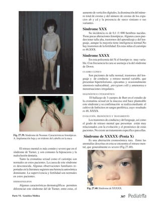 aumento de verticilos digitales, la disminución del núme-
                                                                ro total de crestas y del número de crestas de los espa-
                                                                cios ab y cd y la presencia de surco simiano o sus
                                                                variantes.

                                                                Síndrome XXX
                                                                      Su incidencia es de 0,1 /1 000 hembras nacidas.
                                                                Tiene pocas alteraciones fenotípicas. Algunos casos pue-
                                                                den tener talla alta, trastornos del aprendizaje y del len-
                                                                guaje, aunque la mayoría tiene inteligencia normal.No
                                                                hay trastornos de la fertilidad. En estas niñas el cariotipo
                                                                es 48,XXX.

                                                                Síndrome XXXX
                                                                      En esta polisomía del X el fenotipo es muy varia-
                                                                ble. Con frecuencia la cara se asemeja a la del síndrome
                                                                de Down.
                                                                CUADRO CLÍNICO
                                                                     Son pacientes de talla normal, trastornos del len-
                                                                guaje y de conducta y retraso mental variable, que
                                                                presentan hipertelorismo, epicantus y ocasionalmente
                                                                sinostosis radiocubital, pterygium colli y amenorrea o
                                                                menstruaciones irregulares.
                                                                DIAGNÓSTICO CITOGENÉTICO
                                                                       El hallazgo de 3 cuerpos de Barr en el estudio de
                                                                la cromatina sexual en la mucosa oral hace planteable
                                                                este síndrome y su confirmación se realiza mediante el
                                                                cultivo de linfocitos en sangre periférica, cuyo resultado
                                                                es 48, XXXX.
                                                                EVOLUCIÓN, PRONÓSTICO Y TRATAMIENTO
                                                                     Los trastornos de conducta y del lenguaje, así como
                                                                el grado de retraso mental que presentan están muy
                                                                relacionados con la evolución y el pronóstico de estas
                                                                pacientes. No existe un tratamiento específico para ellas.
 Fig. 27.39. Síndrome de Noonan. Características fenotípicas.
 A. Implantación baja y en tridente del cabello en la nuca
                                                                Síndrome de XXXXX (Penta X)
                                                                      Es una aberración cromosómica rara. Entre las
                                                                anomalías descritas en esta se encuentra el retraso men-
                                                                tal, que generalmente es severo (Fig.27.40).
      El retraso mental es más común y severo que en el
 síndrome de Turner, y son comunes la hipoacusia y la
 maloclusión dentaria.
      Tanto la cromatina sexual como el cariotipo son
 normales en estos pacientes. La causa de este síndrome
 es desconocida. Algunas observaciones familiares re-
 portadas en la literatura sugieren una herencia autosómica
 dominante. La supervivencia y fertilidad son normales
 en estos pacientes.
 DERMATOGLIFOS
      Algunas características dermatoglíficas permiten
 diferenciar este síndrome del de Turner, entre estas, el           Fig. 27.40. Síndrome de XXXXX.

Parte VI. Genética Médica                                                                          307
 