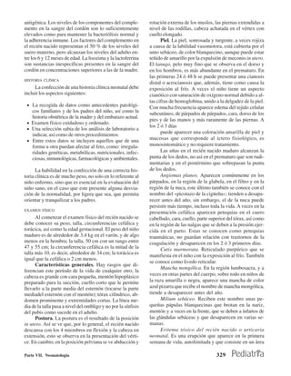 antigénica. Los niveles de los componentes del comple-          rotación externa de los muslos, las piernas extendidas a
mento en la sangre del cordón son lo suficientemente            nivel de las rodillas, cabeza achatada en el vértex con
elevados como para mantener la bacteriólisis normal y           cuello elongado.
la adherencia inmune. Los factores del complemento en                 Piel. La piel, sonrosada y turgente, a veces rojiza
el recién nacido representan el 50 % de los niveles del         a causa de la labilidad vasomotora, está cubierta por el
suero materno, pero alcanzan los niveles del adulto en-         unto sebáceo, de color blanquecino, aunque puede estar
tre los 6 y 12 meses de edad. La lisozima y la lactoferrina     teñido de amarillo por la expulsión de meconio in utero.
son sustancias inespecíficas presentes en la sangre del         El lanugo, pelo muy fino que se observa en el dorso y
cordón en concentraciones superiores a las de la madre.         en los hombros, es más abundante en el prematuro. En
                                                                las primeras 24 ó 48 h se puede presentar una cianosis
HISTORIA CLÍNICA
                                                                distal o acrocianosis que, además, tiene como causa la
     La confección de una historia clínica neonatal debe        exposición al frío. A veces el niño tiene un aspecto
incluir los aspectos siguientes:                                cianótico con saturación de oxígeno normal debido a al-
                                                                tas cifras de hemoglobina, unido a la delgadez de la piel.
 • La recogida de datos como antecedentes patológi-             Con mucha frecuencia aparece edema del tejido celular
   cos familiares y de los padres del niño, así como la         subcutáneo, de párpados de párpados, cara, dorso de los
   historia obstétrica de la madre y del embarazo actual.
                                                                pies y de las manos y más raramente de las piernas. A
 • Examen físico cuidadoso y ordenado.
                                                                los 2 ó 3 días
 • Una selección sabia de los análisis de laboratorio a
                                                                      puede aparecer una coloración amarilla de piel y
   indicar, así como de otros procedimientos.
 • Entre estos datos se incluyen aquellos que de una
                                                                mucosas que corresponde al íctero fisiológico, es
   forma u otra puedan afectar al feto, como: irregula-         monosintomático y no requiere tratamiento.
   ridades genéticas, metabólicas, nutricionales, infec-              Las uñas en el recién nacido maduro alcanzan la
   ciosas, inmunológicas, farmacológicas y ambientales.         punta de los dedos, no así en el prematuro que son rudi-
                                                                mentarias y en el postérmino que sobrepasan la punta
      La habilidad en la confección de una correcta his-        de los dedos.
toria clínica es de mucho peso, no solo en lo referente al            Angiomas planos. Aparecen comúnmente en los
niño enfermo, sino que es esencial en la evaluación del         párpados, en la región de la glabela, en el filtro y en la
niño sano, en el caso que este presente alguna desvia-          región de la nuca, este último también se conoce con el
ción de la normalidad, por ligera que sea, que permita          nombre del «picotazo de la cigüeña»; tienden a desapa-
orientar y tranquilizar a los padres.                           recer antes del año, sin embargo, el de la nuca puede
                                                                persistir más tiempo, incluso toda la vida. A veces en la
EXAMEN FÍSICO
                                                                presentación cefálica aparecen petequias en el cuero
      Al comenzar el examen físico del recién nacido se         cabelludo, cara, cuello, parte superior del tórax, así como
debe conocer su peso, talla, circunferencias cefálica y         en la región de las nalgas que se deben a la presión ejer-
torácica, así como la edad gestacional. El peso del niño        cida en el parto. Estas se conocen como petequias
maduro es de alrededor de 3,4 kg en el varón, y de algo         traumáticas, no guardan relación con trastornos de la
menos en la hembra; la talla, 50 cm con un rango entre          coagulación y desaparecen en los 2 ó 3 primeros días.
47 y 55 cm; la circunferencia cefálica es la mitad de la              Cutis marmorata. Reticulado purpúrico que se
talla más 10, es decir, alrededor de 34 cm; la torácica es
                                                                manifiesta en el niño con la exposición al frío. También
igual que la cefálica o 2 cm menos.
                                                                se conoce como livedo reticular.
      Características generales. Hay rasgos que di-
                                                                      Mancha mongólica. En la región lumbosacra, y a
ferencian este período de la vida de cualquier otro; la
cabeza es grande con cara pequeña, mentón hipoplásico           veces en otras partes del cuerpo, sobre todo en niños de
preparado para la succión, cuello corto que le permite          la raza amarilla o negra, aparece una mancha de color
llevarlo a la parte media del esternón (tocarse la parte        azul pizarra que recibe el nombre de mancha mongólica,
mediadel esternón con el mentón); tórax cilíndrico, ab-         tiende a desaparecer antes del año.
domen prominente y extremidades cortas. La línea me-                  Milium sebáceo. Reciben este nombre unas pe-
dia de la talla pasa a nivel del ombligo y no por la sínfisis   queñas pápulas blanquecinas que brotan en la nariz,
del pubis como sucede en el adulto.                             mentón y a veces en la frente, que se deben a infartos de
      Postura. La postura es el resultado de la posición        las glándulas sebáceas y que desaparecen en varias se-
in utero. Así se ve que, por lo general, el recién nacido       manas.
descansa con los 4 miembros en flexión y la cabeza en                 Eritema tóxico del recién nacido o urticaria
extensión, esto se observa en la presentación del vérti-        neonatal. Es una erupción que aparece en la primera
ce. En cambio, en la posición pelviana se ve abducción y        semana de vida, autolimitada y que consiste en un área

Parte VII. Neonatología                                                                           329
 