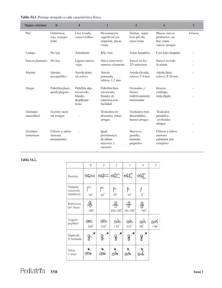 Tabla 34.1. Puntaje otorgado a cada característica física

  Signos externos        0                 1                  2                    3                  4                5

   Piel              Gelatinosa,         Lisa, rosada,    Descamación          Grietas, super-   Placas, surcos      Gruesa,
                     roja, transpa-      venas visibles   superficial y/o      ficie pá1ida,     profundos, no
                     rente                                erupción, pocas      raras venas       hay venas
                                                          venas                                  surcos, arrugas

   Lanugo            No hay              Abundante        Más fino             Áreas lampiñas    Casi todo lampiño     -

   Surcos plantares No hay               Ligeras marcas   Surco transverso     Surcos en los     Surcos en toda        -
                                         rojas            anterior solamente   2/3 anteriores    la planta             -

   Mamas             Apenas              Areola plana     Areola               Areola elevada,   Areola llena          -
                     perceptibles        sin relieve      punteada,            relieve: 3-4 mm   relieve: 5-10 mm
                                                          relieve: 1-2 mm

   Orejas            Pabellón plano,     Pabellón algo    Pabellón bien        Formadas y        Grueso                -
                     queda plegado       encurvado,       encurvado,           firmes;           cartílago,
                                         blando,          blando, se           enderezamiento    oreja rígida          -
                                         despliegue       endereza con         inconstante
                                         lento            facilidad

   Genitales         Escroto vacío                        Testículos en        Testículos bien   Testículos
   masculinos        sin arrugas           -              descenso, pocas      descendidos,      péndulos,
                                                          arrugas              buenas arrugas     profundas
                                                                                                 arrugas               -

   Genilales         Clítoris y labios     -              Igual                Mayores           Clítoris y labios     -
   femeninos         menores                              prominencia          grandes,          menores
                     prominentes                          de labios            menores           cubiertos por
                                                          mayores y            pequeños          completo
                                                          menores


Tabla 34.2.




                     350                                                                                               Tomo I
 