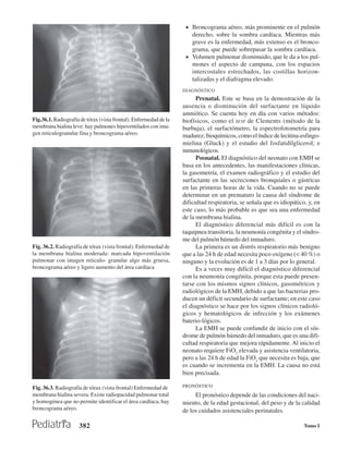 • Broncograma aéreo, más prominente en el pulmón
                                                                      derecho, sobre la sombra cardíaca. Mientras más
                                                                      grave es la enfermedad, más extenso es el bronco-
                                                                      grama, que puede sobrepasar la sombra cardíaca.
                                                                    • Volumen pulmonar disminuido, que le da a los pul-
                                                                      mones el aspecto de campana, con los espacios
                                                                      intercostales estrechados, las costillas horizon-
                                                                      talizadas y el diafragma elevado.
                                                                   DIAGNÓSTICO
                                                                         Prenatal. Este se basa en la demostración de la
                                                                   ausencia o disminución del surfactante en líquido
                                                                   amniótico. Se cuenta hoy en día con varios métodos:
Fig.36.1. Radiografía de tórax (vista frontal). Enfermedad de la   biofísicos, como el test de Clements (método de la
membrana hialina leve: hay pulmones hipoventilados con ima-        burbuja), el surfactómetro, la espectrofotometría para
gen reticulogranular fina y broncograma aéreo.                     madurez; bioquímicos, como el índice de lecitina-esfingo-
                                                                   mielina (Gluck) y el estudio del fosfatidilglicerol; e
                                                                   inmunológicos.
                                                                         Posnatal. El diagnóstico del neonato con EMH se
                                                                   basa en los antecedentes, las manifestaciones clínicas,
                                                                   la gasometría, el examen radiográfico y el estudio del
                                                                   surfactante en las secreciones bronquiales o gástricas
                                                                   en las primeras horas de la vida. Cuando no se puede
                                                                   determinar en un prematuro la causa del síndrome de
                                                                   dificultad respiratoria, se señala que es idiopático, y, en
                                                                   este caso, lo más probable es que sea una enfermedad
                                                                   de la membrana hialina.
                                                                         El diagnóstico diferencial más difícil es con la
                                                                   taquipnea transitoria, la neumonía congénita y el síndro-
                                                                   me del pulmón húmedo del inmaduro.
Fig. 36.2. Radiografía de tórax (vista frontal). Enfermedad de           La primera es un distrés respiratorio más benigno
la membrana hialina moderada: marcada hipoventilación              que a las 24 h de edad necesita poco oxígeno (< 40 %) o
pulmonar con imagen reticulo- granular algo más gruesa,            ninguno y la evolución es de 1 a 3 días por lo general.
broncograma aéreo y ligero aumento del área cardíaca                     Es a veces muy difícil el diagnóstico diferencial
                                                                   con la neumonía congénita, porque esta puede presen-
                                                                   tarse con los mismos signos clínicos, gasométricos y
                                                                   radiológicos de la EMH, debido a que las bacterias pro-
                                                                   ducen un déficit secundario de surfactante; en este caso
                                                                   el diagnóstico se hace por los signos clínicos radioló-
                                                                   gicos y hematológicos de infección y los exámenes
                                                                   baterio-lógicos.
                                                                         La EMH se puede confundir de inicio con el sín-
                                                                   drome de pulmón húmedo del inmaduro, que es una difi-
                                                                   cultad respiratoria que mejora rápidamente. Al inicio el
                                                                   neonato requiere FiO2 elevada y asistencia ventilatoria,
                                                                   pero a las 24 h de edad la FiO2 que necesita es baja, que
                                                                   es cuando se incrementa en la EMH. La causa no está
                                                                   bien precisada.

Fig. 36.3. Radiografía de tórax (vista frontal) Enfermedad de      PRONÓSTICO
membrana hialina severa: Existe radiopacidad pulmonar total             El pronóstico depende de las condiciones del naci-
y homogénea que no permite identificar el área cardíaca, hay       miento, de la edad gestacional, del peso y de la calidad
broncograma aéreo.                                                 de los cuidados asistenciales perinatales.

                     382                                                                                               Tomo I
 