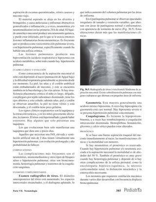 aspiración de escamas queratinizadas, vérnix caseoso y         que indica aumento del volumen pulmonar por las áreas
meconio viejo.                                                 de enfisema.
     El material aspirado se aloja en los alveolos y                En el parénquima pulmonar se observan opacidades
bronquiolos, y causa atelectasias y enfisemas obstructivos     irregulares de tamaño y extensión variables, que alter-
generalizados e inflamación, y a veces, neumotórax y/o         nan con áreas de parénquima normal o enfisematoso,
neumomediastino en las primeras 24 h de edad. El líqui-        con apariencia de tormenta de nieve (Fig. 36.5). Estas
do amniótico meconial produce una neumonitis química,          alteraciones duran más que las manifestaciones clí-
y puede estar infectado, por lo que se le asocia entonces      nicas.
lesiones inflamatorias bronconeumónicas. Es frecuente
que se produzca una vasoconstricción pulmonar severa,
con hipertensión pulmonar, específicamente cuando ha
habido una asfixia crónica.
     Las lesiones pulmonares producen una
hipoventilación (acidosis respiratoria) e hipoxemia con
acidosis metabólica, sobre todo cuando hay hipertensión
pulmonar.
CUADRO CLÍNICO Y EVOLUCIÓN
      Como consecuencia de la aspiración meconial el
niño está deprimido al nacer (puntuación de Apgar baja)
y la dificultad respiratoria generalmente se presenta desde
ese momento. La piel, las uñas y el cordón umbilical
están embadurnados de meconio, y este se encuentra
también en la bucofaringe y las vías aéreas. Si hay insu-      Fig. 36.5. Radiografía de tórax (vista frontal) Síndrome de as-
ficiencia placentaria crónica el niño es largo, delgado,       piración meconial: Existe sobredistensión pulmonar con imá-
                                                               genes radiopacas que alternan con pequeñas áreas de enfisema.
con pliegues por tejido subcutáneo disminuido, tiene los
ojos abiertos y esta ceñudo; además uñas, piel y cordón
se observan amarillos; la piel no tiene vérnix y está               Gasometría. Esta muestra generalmente una
descamada, y el cordón tiene poca gelatina.                    acidosis mixta e hipoxemia. A veces hay hipocapnia o la
      Los signos clínicos respiratorios son la taquipnea y     gasometría está casi normal. Hay hipoxemia severa si
la retracción torácica, y en los niños gravemente afecta-      se presenta hipertensión pulmonar concomitante.
dos, la cianosis. El tórax está hiperinsuflado y puede haber        Coagulograma. Es fecuente la hipoprotrom-
estertores. Hay algunos que solo presentan una                 binemia, y a veces hay trombocitopenia o coagulación
taquipnea.                                                     intravascular diseminada. Hemoglobina, hematócrito,
      Los que evolucionan bien solo manifiestan una            glicemia y calcio sérico pueden estar alterados.
taquipnea que dura uno o pocos días.                           PRONÓSTICO
      Aquellos que necesitan una FiO2 elevada y venti-              Si se hace una buena aspiración traqueal del me-
lación artificial más de 2 días tienen virtualmente una        conio inmediatamente al nacer, las manifestaciones clí-
hipertensión pulmonar, con evolución prolongada y alta         nicas y la mortalidad son menores.
probabilidad de fallecer.                                           Sí hay neumotórax el pronóstico es reservado.
COMPLICACIONES
                                                               Cuando hay hipertensión pulmonar y/o neumonía aso-
                                                               ciada a la aspiración meconial la mortalidad es de alre-
     Las complicaciones más frecuentes son el
                                                               dedor del 50 %. También el pronóstico es muy grave
neumotórax, neumomediastino y otros tipos de bloqueo
                                                               cuando hay hemorragia pulmonar y depende de si hay
aéreo e hipertensión pulmonar; otras son bronconeu-
monía, hemorragia pulmonar y trastornos de la coagula-         otras complicaciones de la asfixia perinatal, como la
ción sanguínea.                                                encefalopatía hipóxico-isquémica, la necrosis
                                                               corticomedular renal, la disfunción miocárdica y la
EXÁMENES COMPLEMENTARIOS                                       enterocolitis necrosante.
      Examen radiográfico de tórax. EI diámetro                     Los neonatos que requieren ventilación mecánica
anteroposterior del tórax está aumentado, los espacios         durante varios días desarrollan con frecuencia displasia
intercostales ensanchados, y el diafragma aplanado, lo         broncopulmonar.

Parte VII. Neonatología                                                                            385
 