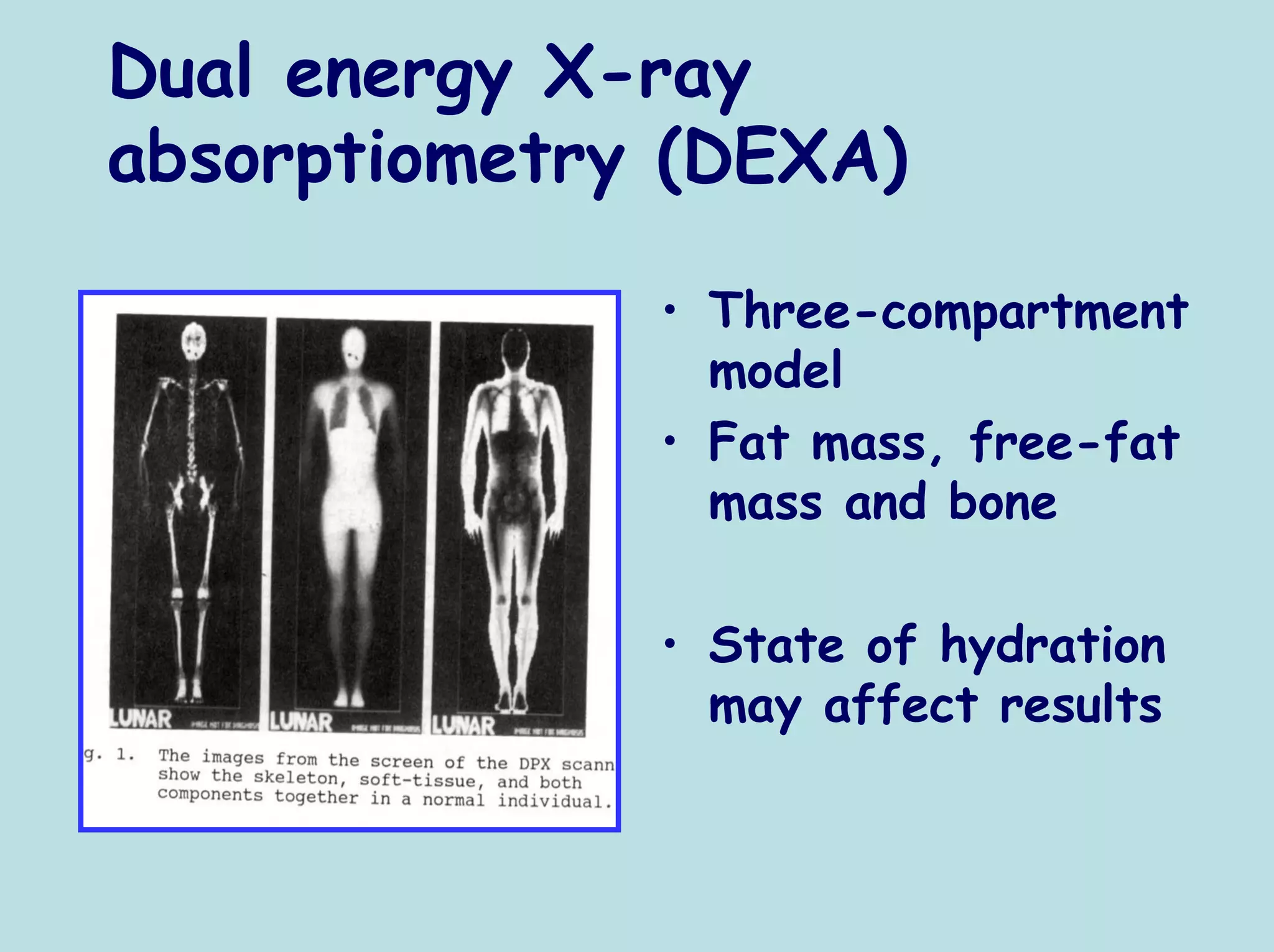 Dual energy X-ray
absorptiometry (DEXA)

              • Three-compartment
                model
              • Fat mass, free-fat
                mass and bone

              • State of hydration
                may affect results
 