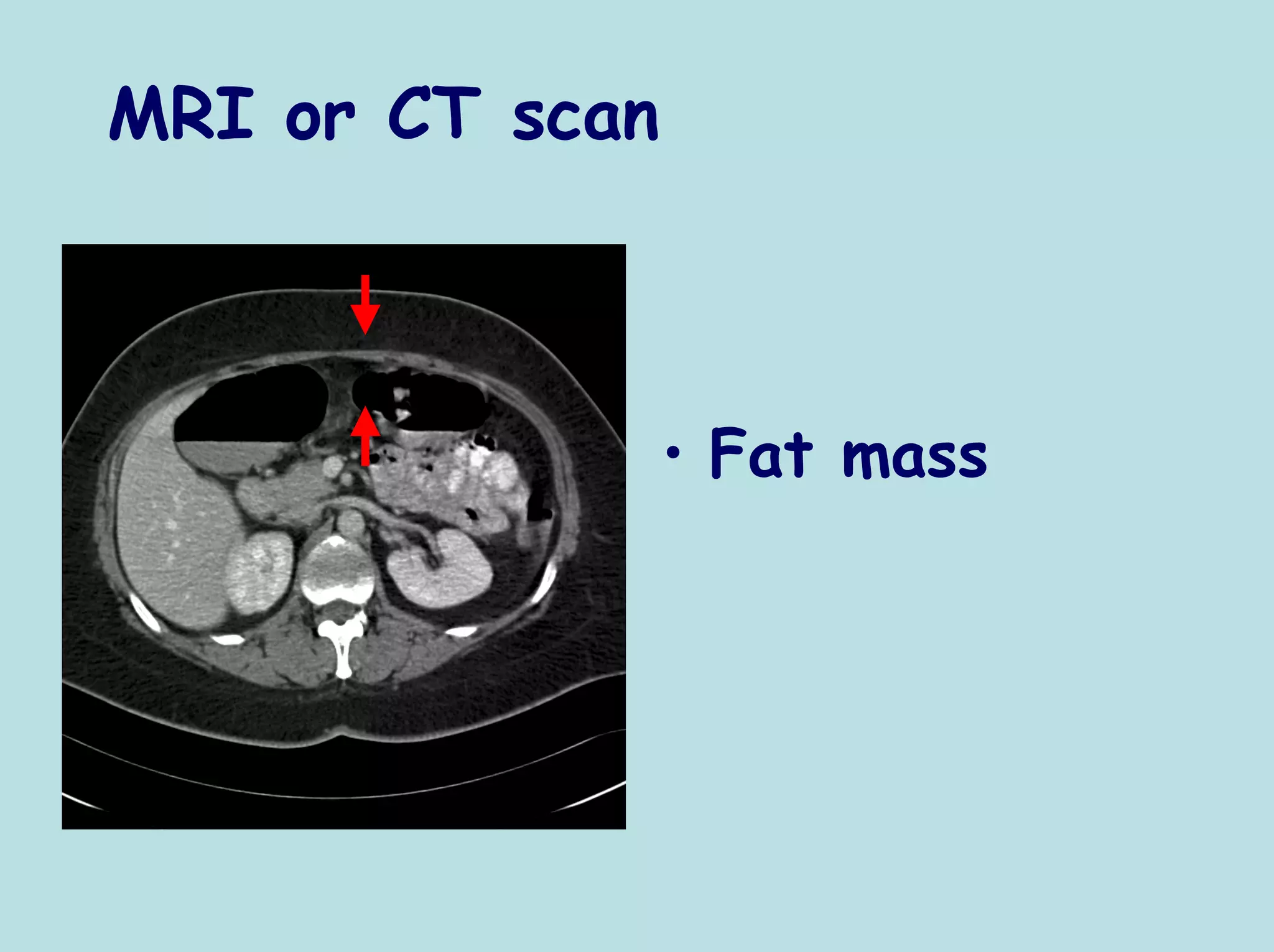 MRI or CT scan



                 • Fat mass
 