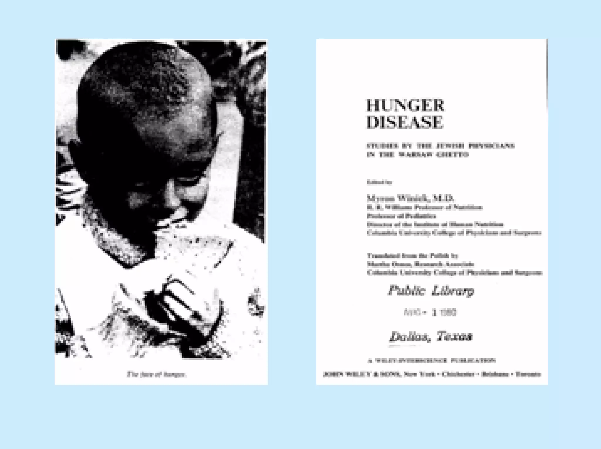 Infectious complications
      and albumin




                  Kudsk et al, JPEN 2003
 