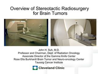 Overview of Stereotactic Radiosurgery
          for Brain Tumors




                      John H. Suh, M.D.
    Professor and Chairman, Dept. of Radiation Oncology
       Associate Director of the Gamma Knife Center
 Rose Ella Burkhardt Brain Tumor and Neuro-oncology Center
                  Taussig Cancer Institute
 