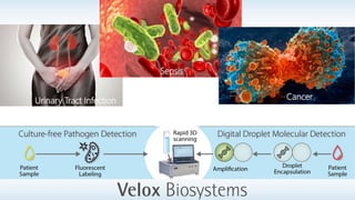 Urinary Tract Infection
Sepsis
Cancer
 