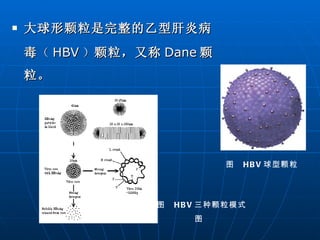 大球形颗粒是完整的乙型肝炎病毒 （ HBV ） 颗粒，又称 Dane 颗粒。 图  HBV 球型颗粒 图  HBV 三种颗粒模式图   