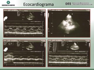 Ecocardiograma

 
