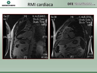 RMI cardiaca

 