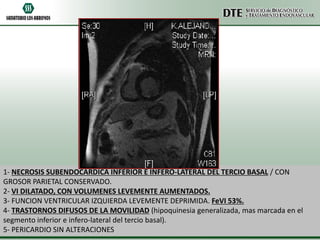 1- NECROSIS SUBENDOCARDICA INFERIOR E INFERO-LATERAL DEL TERCIO BASAL / CON
GROSOR PARIETAL CONSERVADO.
2- VI DILATADO, CON VOLUMENES LEVEMENTE AUMENTADOS.
3- FUNCION VENTRICULAR IZQUIERDA LEVEMENTE DEPRIMIDA. FeVI 53%.
4- TRASTORNOS DIFUSOS DE LA MOVILIDAD (hipoquinesia generalizada, mas marcada en el
segmento inferior e infero-lateral del tercio basal).
5- PERICARDIO SIN ALTERACIONES

 