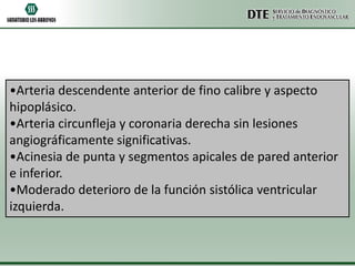 •Arteria descendente anterior de fino calibre y aspecto
hipoplásico.
•Arteria circunfleja y coronaria derecha sin lesiones
angiográficamente significativas.
•Acinesia de punta y segmentos apicales de pared anterior
e inferior.
•Moderado deterioro de la función sistólica ventricular
izquierda.

 