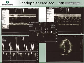 Ecodoppler cardíaco

 
