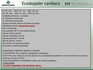 Ecodoppler cardíaco
AI: 30 mm. DDVI: 47 mm. SIDV: 10 mm.
AO: 26 mm. DSVI: 27 mm. PPD: 10 mm.
Cavidades derechas : normales
AI: diámetro conservado
VI: diámetro conservado
Espesor parietal: dentro de limites normales
Motilidad parietal: hipoquinesia apical
FSVI: conservada
Fey estimada 60 % por bidimensional.
Válvula mitral: normal
Válvula tricúspide: normal
Válvula pulmonar: normal
Válvula aórtica: normal
Raíz aórtica: sin particularidades
Pericardio: sin particularidades
ECODOPPLER CARDIACO (BLANCO y NEGRO):
FLUJO MITRAL: No se registra regurgitación patológica.
FLUJO TSVI y Ao: el flujo es de tipo laminar no constatándose gradientes ni intra ventricular ni valvular.
Volumen minuto 6.5 l/min.
FLUJO TRICUSPIDEO y PULMONAR: dentro de limites fisiológicos.
CONCLUSION:
ESTUDIO COMPATIBLE CON NECROSIS APICAL.

 
