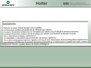 Holter

 