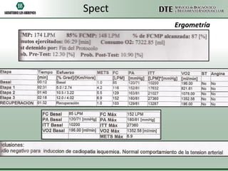 Spect
Ergometría

 
