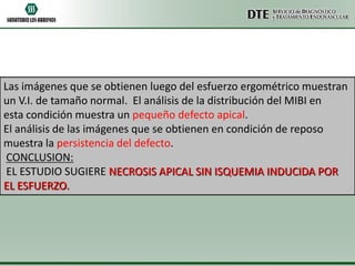 Las imágenes que se obtienen luego del esfuerzo ergométrico muestran
un V.I. de tamaño normal. El análisis de la distribución del MIBI en
esta condición muestra un pequeño defecto apical.
El análisis de las imágenes que se obtienen en condición de reposo
muestra la persistencia del defecto.
CONCLUSION:
EL ESTUDIO SUGIERE NECROSIS APICAL SIN ISQUEMIA INDUCIDA POR
EL ESFUERZO.

 