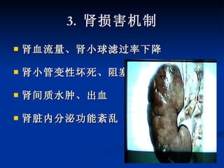 3.  肾损害机制 肾血流量、肾小球滤过率下降 肾小管变性坏死、阻塞 肾间质水肿、出血 肾脏内分泌功能紊乱 