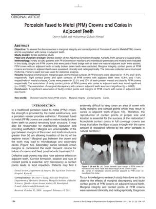 ORIGINAL ARTICLE

            Porcelain Fused to Metal (PFM) Crowns and Caries in
                               Adjacent Teeth
                                         Durr-e-Sadaf and Muhammad Zubair Ahmad


  ABSTRACT
  Objective: To assess the discrepancies in marginal integrity and contact points of Porcelain Fused to Metal (PFM) crowns
  and its association with caries in adjacent teeth.
  Study Design: Cross-sectional study.
  Place and Duration of Study: Dental Section of the Aga Khan University Hospital, Karachi, from January to August 2009.
  Methodology: Ninety six (96) patients with PFM crowns on maxillary and mandibular premolars and molars were included
  in this study. Single unit PFM crowns that were part of fixed bridge with at least one natural adjacent tooth were studied.
  PFM crown with no adjacent tooth or badly broken down teeth were excluded. Marginal integrity, contact points of PFM
  crowns and caries in adjacent teeth were assessed clinically and radiographically. The data was collected on a structured
  Proforma. Fisher's exact test was used for statistical analysis.
  Results: Marginal overhang and marginal gaps on the mesial surfaces of PFM crowns were observed in 17.7% and 13.5%
  respectively. Tight contact points and open contacts of PFM crowns with adjacent teeth were 15.6% and 17.8%
  respectively on mesial surfaces. Caries were present in 33.3% and 20% of teeth present mesial and distal to PFM crowns
  respectively. The association of faulty contact points of PFM crowns with caries in adjacent teeth was found significant
  (p < 0.001). The association of marginal discrepancy with caries in adjacent teeth was found significant (p = 0.002).
  Conclusion: A significant association of faulty contact points and margins of PFM crowns with caries in adjacent teeth
  was found.

  Key words:     Porcelain fused to metal (PFM) crowns. Marginal integrity. Contact points. Caries.


                    INTRODUCTION                                     extremely difficult to keep clean an area of crown with
In a traditional porcelain fused to metal (PFM) crown,               faulty margins and contact points which may result in
the strength is provided by the metal substructure, and              caries in adjacent teeth (Figure 1B). Therefore, the
a porcelain veneer provides esthetics.1 Porcelain fused              reproduction of contact points of proper size and
to metal (PFM) crowns are used to restore badly broken               location is essential for the success of the restoration.6
down teeth to protect remaining tooth structure. It may              Acceptable contact points in full coverage crowns are
also be responsible for maintaining occlusion and                    those that allow the floss to pass through with the same
providing aesthetics.2 Margins are unacceptable, if the              amount of resistance offered by the other contacts in
gap between margins of the crown and tooth structure is              natural dentition.3
greater than 50 um allowing insertion of the tip of the
explorer inside.3 Marginal gap between the crown and
the tooth may lead to microleakage and secondary
caries (Figure 1A). Secondary caries beneath crown
margins is considered the most frequent reason for
failure of crowns and fixed prosthodontic treatment.4,5
Defective cast crowns may also have adverse effects on
adjacent teeth. Correct formation, location and size of
contact points is essential. Any discrepancy in contact                 A                                      B
points leads to food impaction. Patients may find it                   Figure 1 (A and B): (A). Caries beneath open margin of PFM crown on
                                                                       mandibular first molar. Note that distal margin of this crown is open.
  Dental Section, Department of Surgery, The Aga Khan University       (B). Caries in mandibular second premolar adjacent to PFM crown on
  Hospital, Karachi.                                                   mandibular first molar.

  Correspondence: Dr. Durr-e-Sadaf, Associate Professor,             To our knowledge no research study has done so far to
  Department of Operative Dentistry, Margalla Institute of Health    observe the effects of marginal discrepancy and faulty
  Sciences, Quaid-e-Azam Avenue, Gulrez-III, Rawalpindi.             contact points of PFM crowns on adjacent natural teeth.
  E-mail: drdurresadaf@hotmail.com                                   Marginal integrity and contact points of PFM crowns
  Received October 15, 2009; accepted February 14, 2011.             were assessed clinically and radiographically. Diagnosis



134                                                           Journal of the College of Physicians and Surgeons Pakistan 2011, Vol. 21 (3): 134-137
 