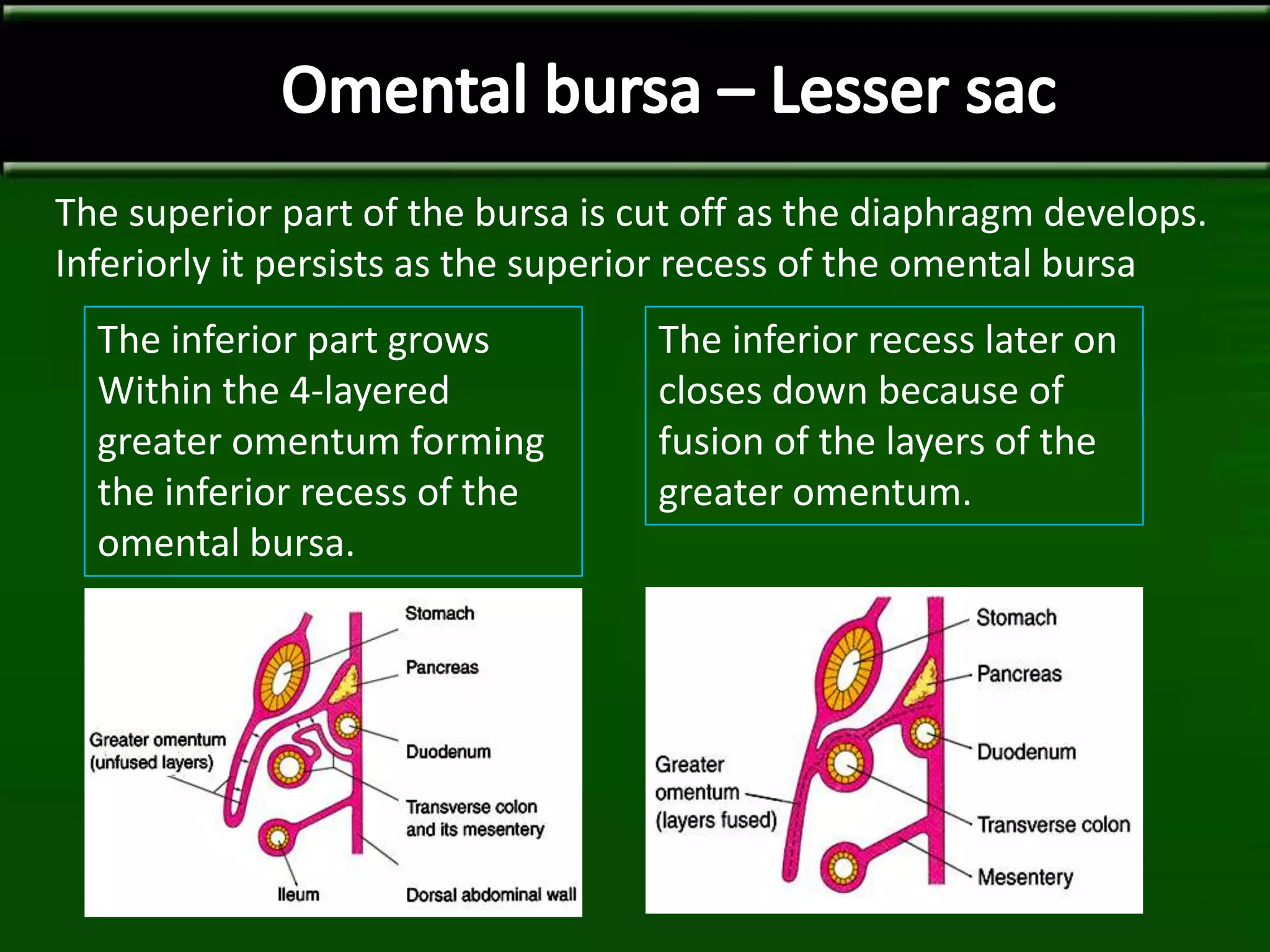 The superior part of the bursa is cut off as the diaphragm develops.
Inferiorly it persists as the superior recess of the omental bursa
The inferior part grows
Within the 4-layered
greater omentum forming
the inferior recess of the
omental bursa.
The inferior recess later on
closes down because of
fusion of the layers of the
greater omentum.
 
