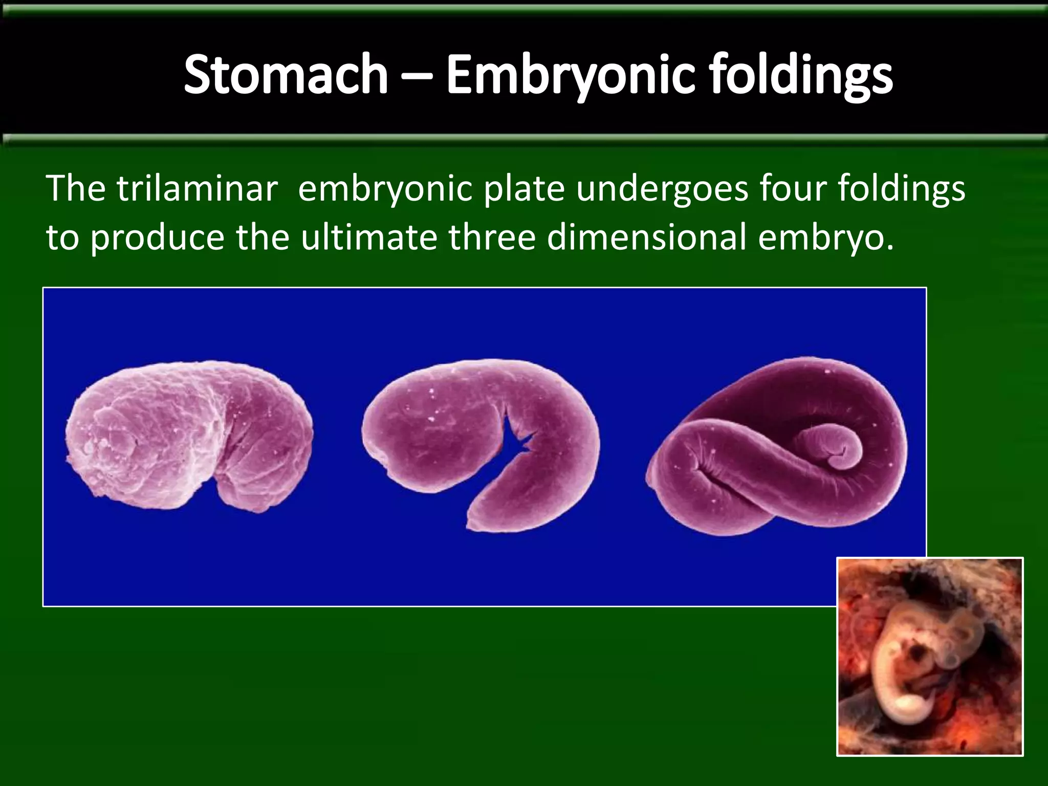 The trilaminar embryonic plate undergoes four foldings
to produce the ultimate three dimensional embryo.
 