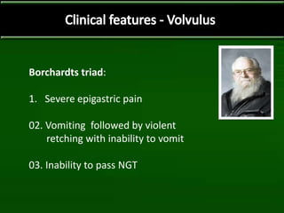 Borchardts triad:
1. Severe epigastric pain
02. Vomiting followed by violent
retching with inability to vomit
03. Inability to pass NGT
 