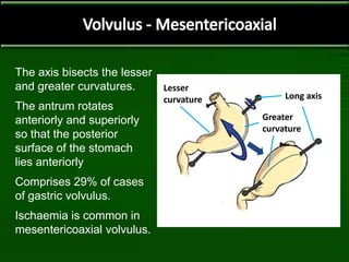 The axis bisects the lesser
and greater curvatures.
The antrum rotates
anteriorly and superiorly
so that the posterior
surface of the stomach
lies anteriorly
Comprises 29% of cases
of gastric volvulus.
Ischaemia is common in
mesentericoaxial volvulus.
Greater
curvature
Long axis
Lesser
curvature
 