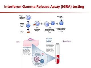 Interferon	
  Gamma	
  Release	
  Assay	
  (IGRA)	
  tes;ng	
  
 