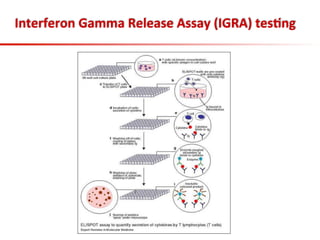 Interferon	
  Gamma	
  Release	
  Assay	
  (IGRA)	
  tes;ng	
  
 