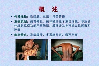概  述 传播途径： 性接触、血液、母婴传播 发病机制： 病毒侵犯、破坏辅助性 T 淋巴细胞，导致机体细胞免疫功能严重缺陷，最终并发各种机会性感染和肿瘤 临床特点： 发病缓慢，多系统损害，病死率高 