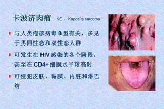 与人类疱疹病毒 8 型有关，多见于男同性恋和双性恋人群 可发生在 HIV 感染的各个阶段，甚至在 CD4+ 细胞水平较高时 可侵犯皮肤、黏膜、内脏和淋巴结 卡波济肉瘤   KS ， Kaposi’s sarcoma 