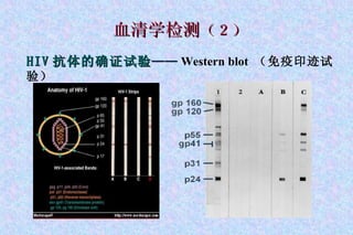 血清学检测 （２） HIV 抗体的确证试验 —— Western blot  （免疫印迹试验） 