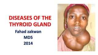 DISEASES OF THE
THYROID GLAND
Fahad zakwan
MD5
2014
 