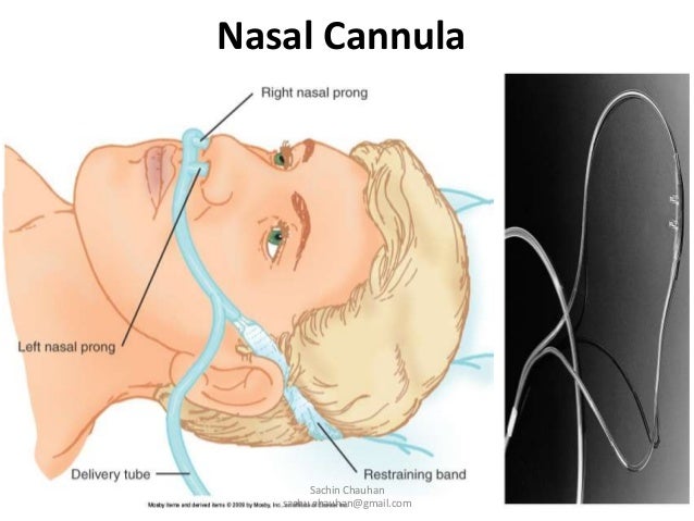 proper way to wear nasal cannula