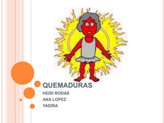 QUEMADURAS
HEIDI RODAS
ANA LOPEZ
YADIRA
 