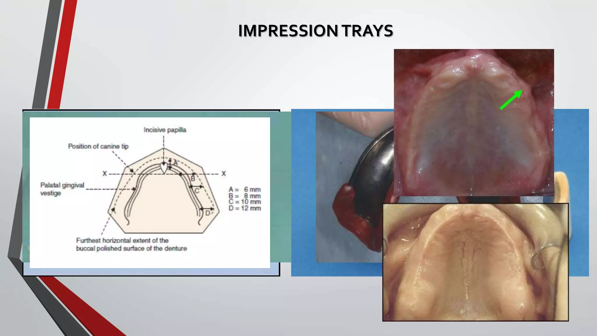 03. denture bearing area and impression techniques | PPTX