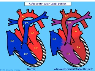 03. Congenital abnormalities of the cardiovascular system.pptx