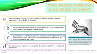 Es la manifestación más rara de la parálisis obstétrica del plexo braquial,
aparece en menos de 2% de los casos.
Se caracteriza por avulsión de las raíces nerviosas C8-T1, sin afectación
de las raíces proximales del plexo braquial.
Clínicamente se manifiesta con mano en “garra” (extensión de la muñeca,
hiperextensión de la articulación metacarpofalángica y flexión de las
articulaciones interfalángicas).
En la mayoría de los casos se acompaña de síndrome de Horner y es de mal
pronóstico.
Parálisis obstétrica del plexo braquialObstetric brachial plexus palsyGabriel Fraind-Maya,1 Luis Eduardo Loyo-Soriano,2 Alfonso Migoya-Nuño3. CrIterIo pediátrico Acta Pediatr Mex. 2021; 42
(2): 85-8.
 
