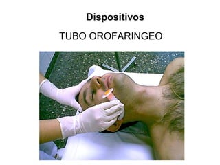 TUBO OROFARINGEO
Dispositivos
 