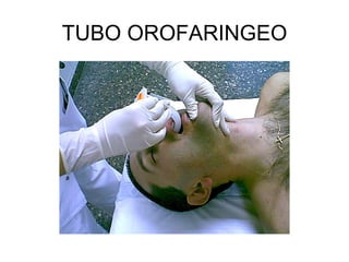 TUBO OROFARINGEO
 